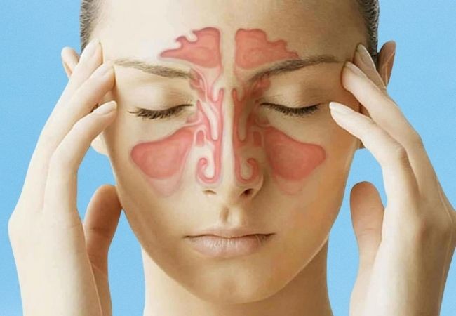 How to Prevent Sinus Infections