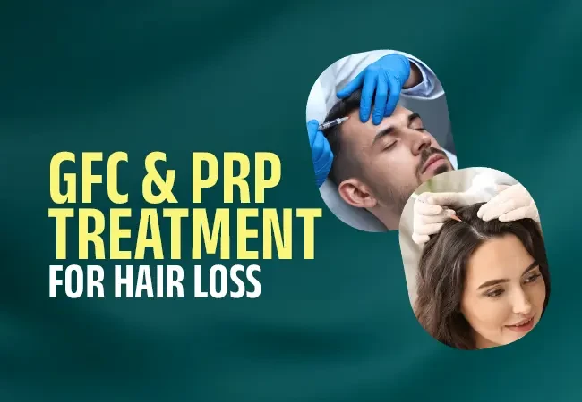 Hair loss treatment