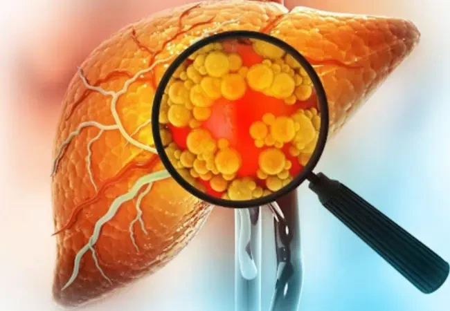 Liver Disease in Young Adults